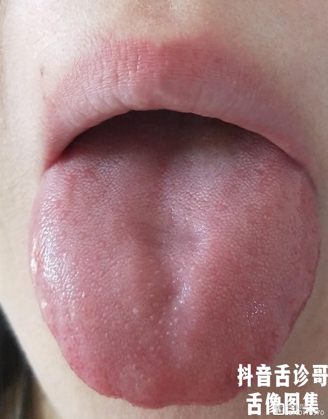 舌头好淡啊好干净啊但是这么干净的舌象真的健康吗站在我的角度答案是