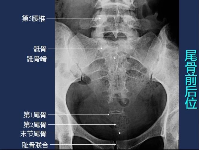 常规x线影像解剖大全