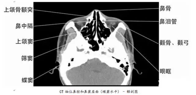 全身ct图谱赶紧收藏了吧