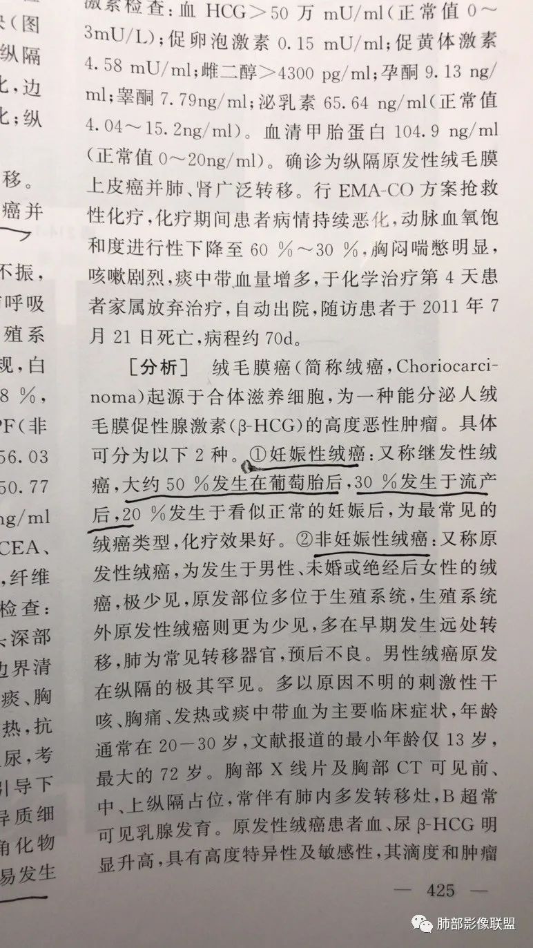 肺部影像系列一见难忘的绒毛膜癌