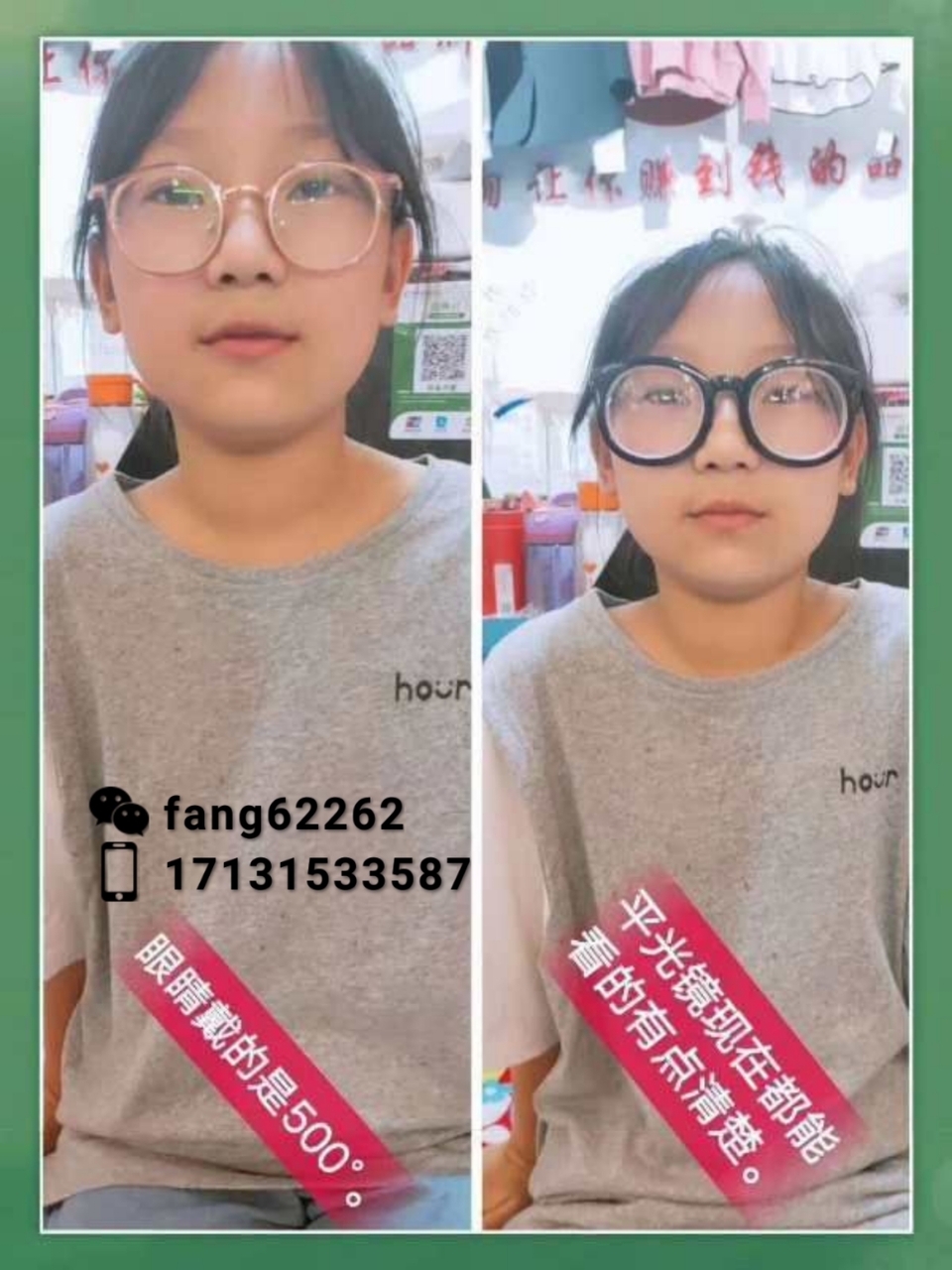孩子近视了怎么样控制孩子眼镜度数的增加