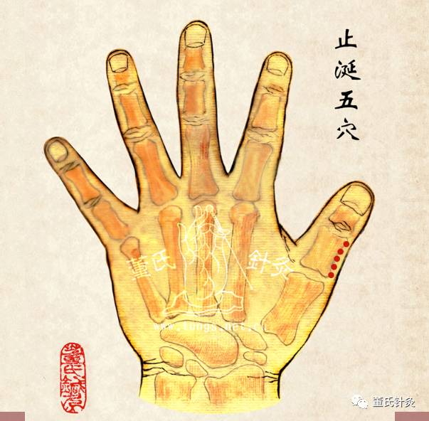 针灸眼科病症处方:眼晴是灵魂之窗,生活中眼睛不適,引响视物功能臨床