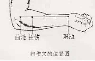 针灸到底有多少常用奇穴百分之90的人都不知道