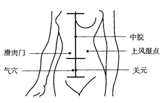 腹针无痛治疗痛症却有奇效