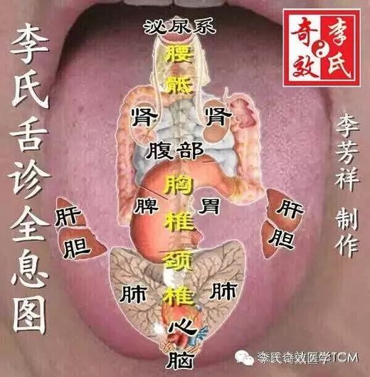 李氏奇效舌诊与望舌用药二