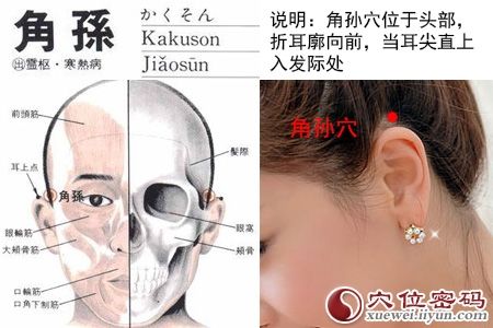 治疗流行性腮腺炎的民间绝招火柴灸