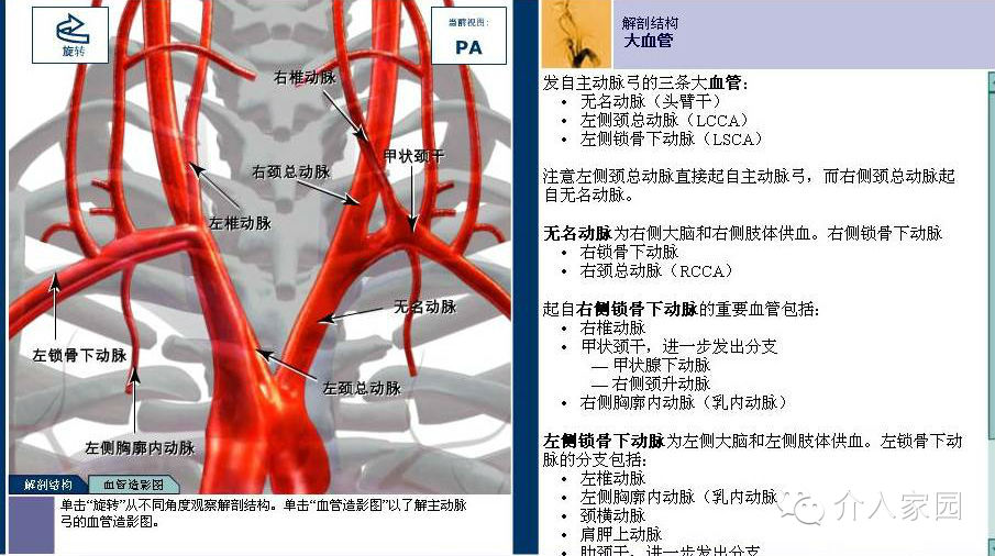 脑动脉解剖图谱(dsa 模型)