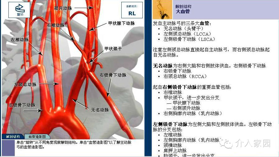 脑动脉解剖图谱dsa模型