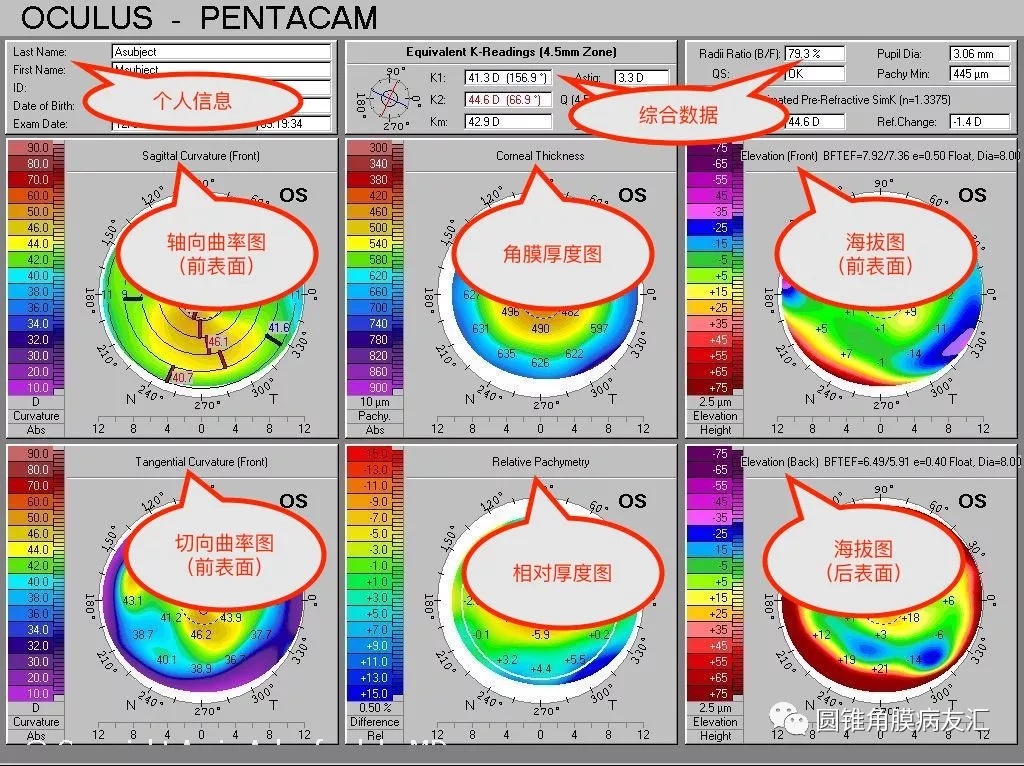 【原】快速入门读懂角膜地形图【圆锥课堂第一讲】