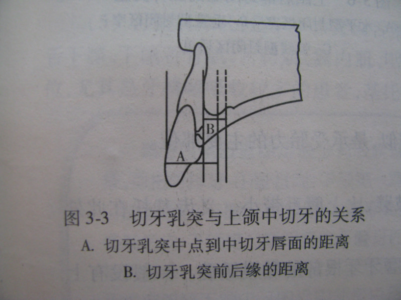 【牙科学堂】活动义齿的印模方法及取模技巧[好网角文章收藏]