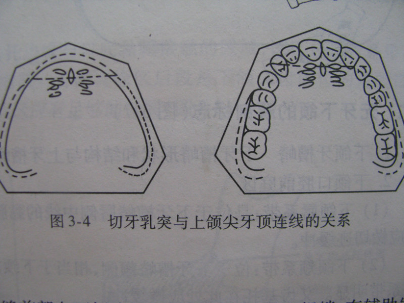 【牙科学堂】活动义齿的印模方法及取模技巧[好网角文章收藏]
