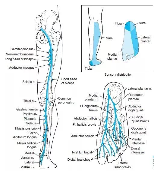 腓浅神经:可能产生马蹄足 4,主要功能丧失:步态损伤:负重期的足部下垂
