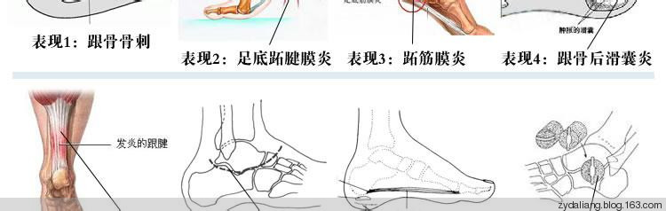 注意保护脚后跟