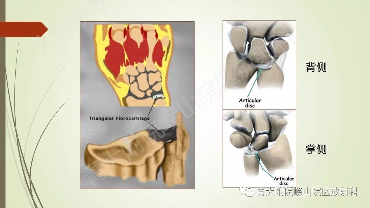 解剖学系列讲座六三角纤维软骨复合体