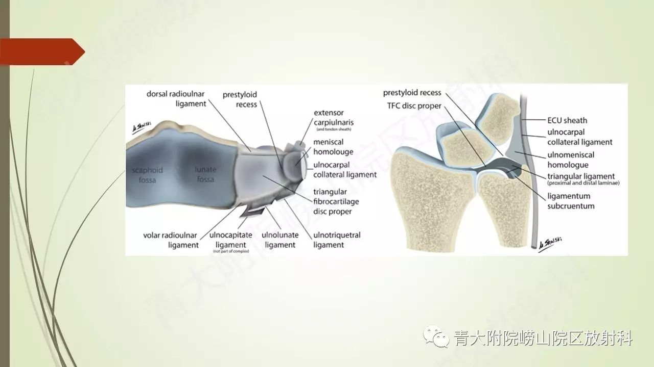 解剖学系列讲座六三角纤维软骨复合体