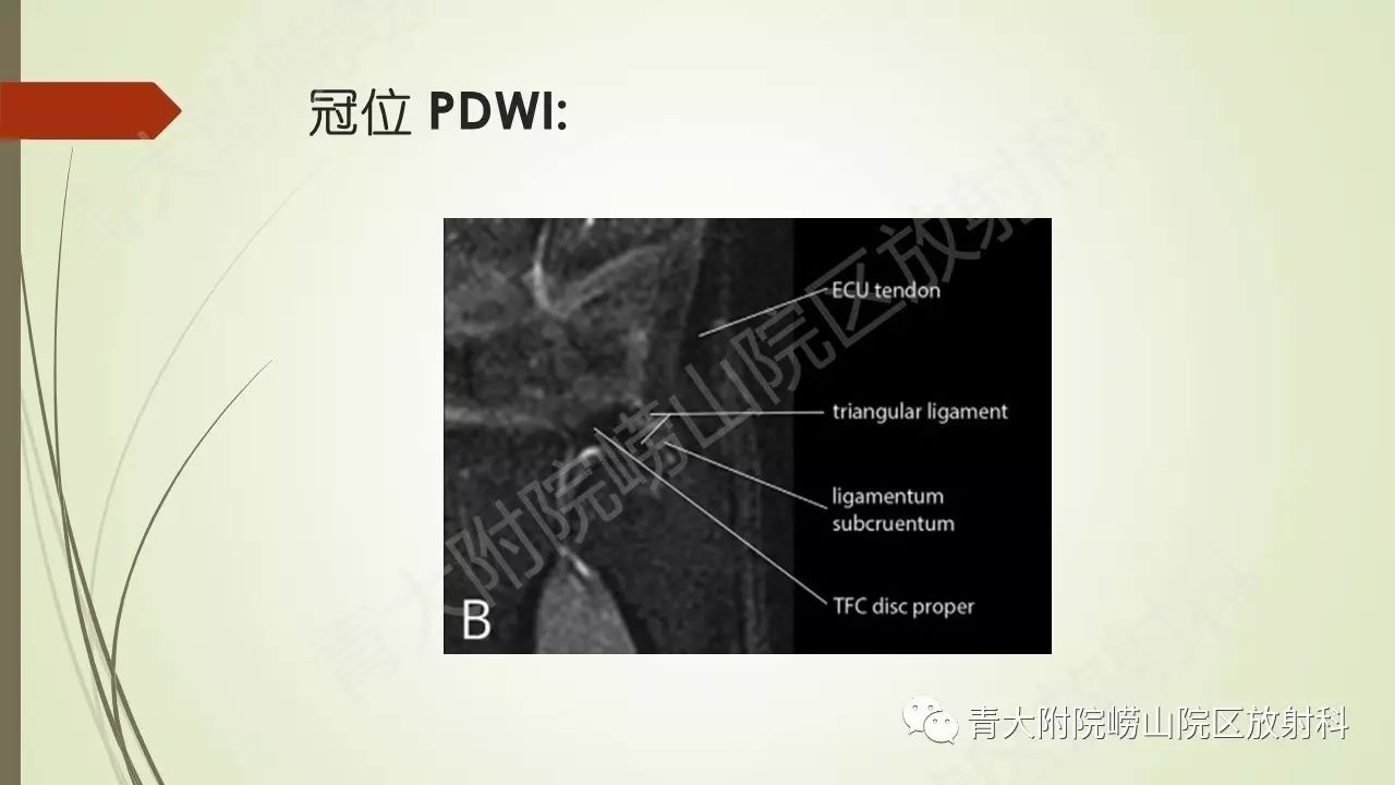 解剖学系列讲座六三角纤维软骨复合体