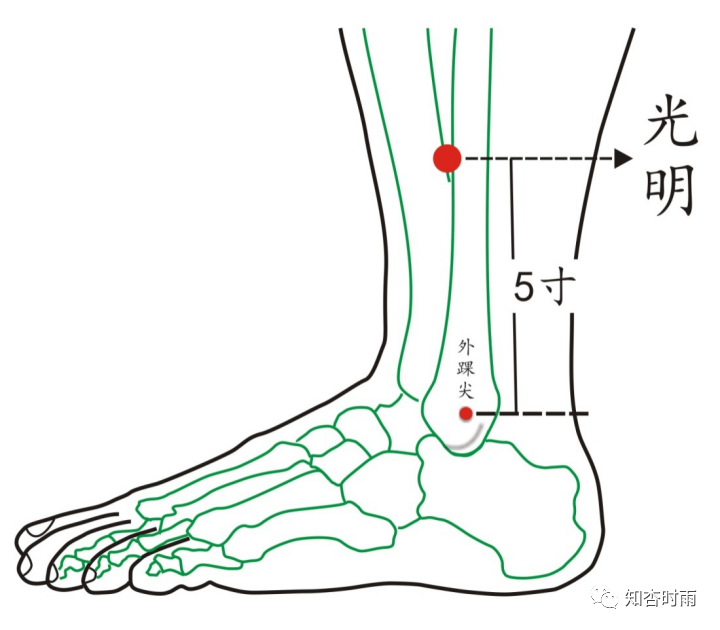 光明穴为胆经络穴内通肝经,肝经系目系.此穴治疗面瘫眼不能闭有奇效.