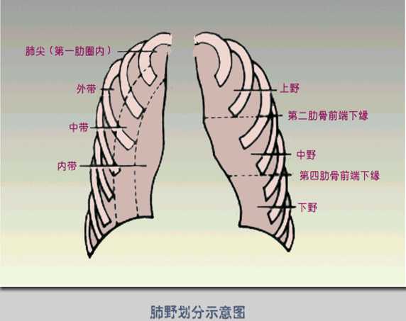 胸廓(肋骨,脊柱等)  认识肋骨是看胸片的基础,肺部病变