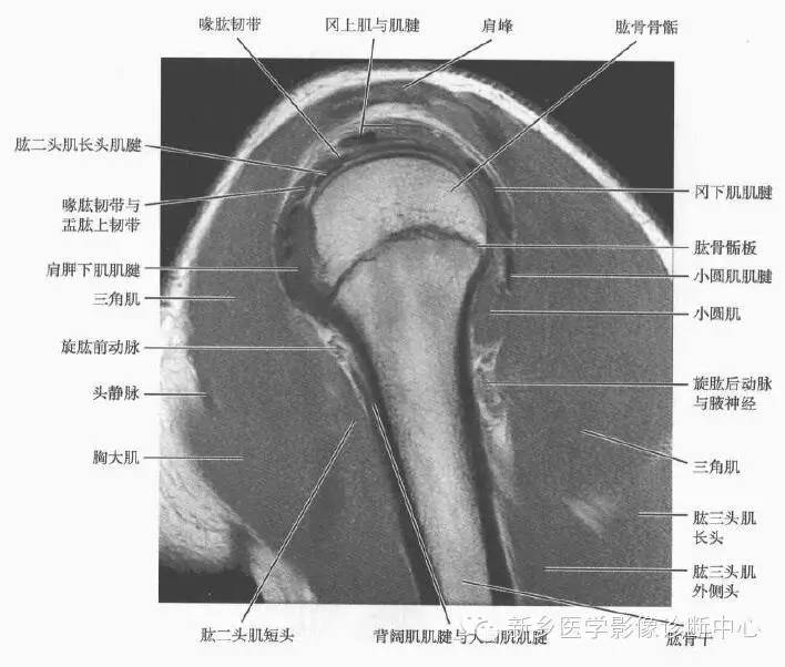 来源:骨骼肌肉mri ct断层解剖