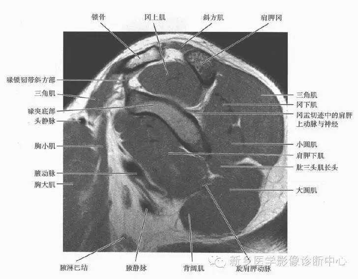 来源:骨骼肌肉mri ct断层解剖