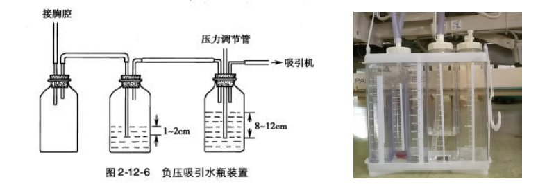 胸腔闭式引流这四点你未必懂