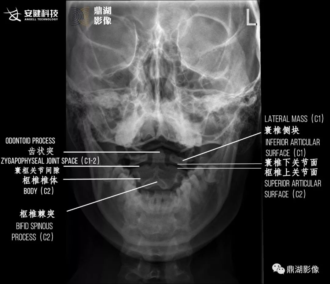 x线高清图谱 | 精致颞下颌关节解剖   x线高清图谱 | 茎突解剖及