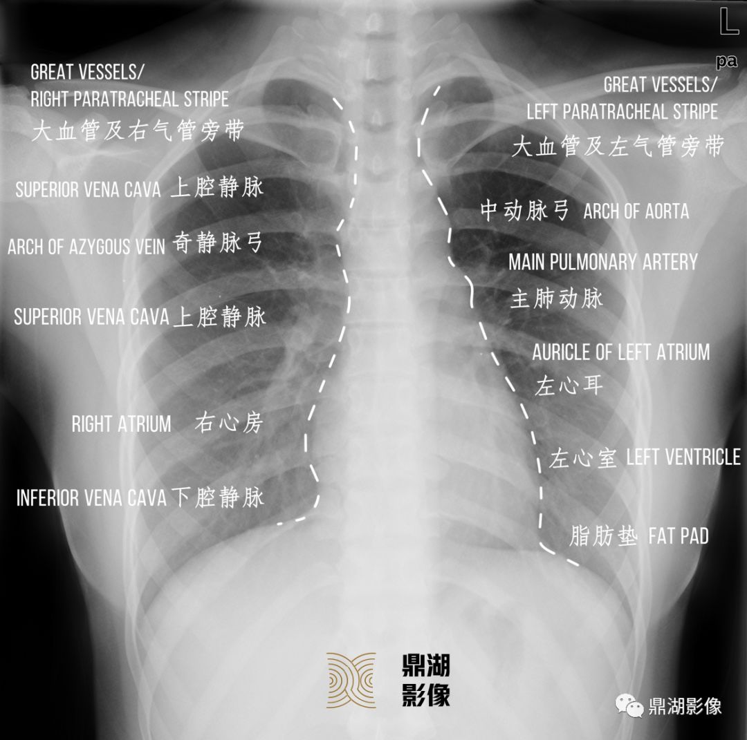 x线高清图谱 | 胸片详细诊断要点x线高清图谱 | 精致肩关节解剖x线