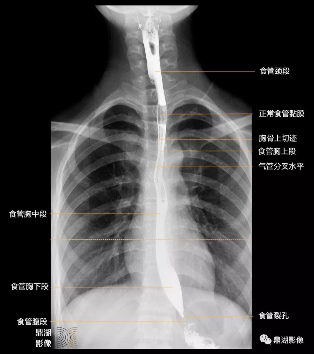 必点收藏全网最全全身x线高清图谱