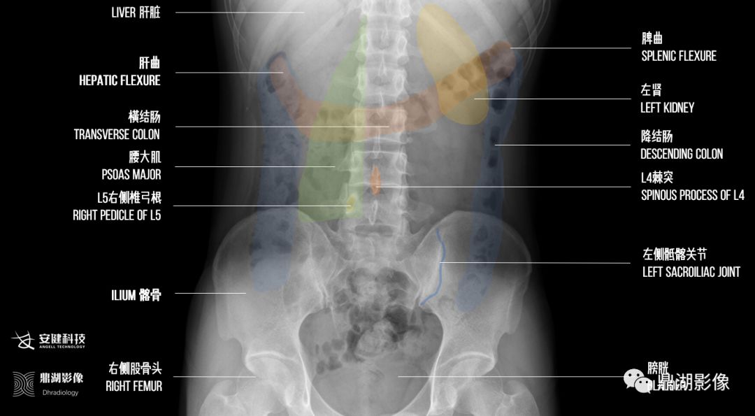 精致结肠造影图谱及检查规范   x线高清图谱 | 精致腹部解剖   x线