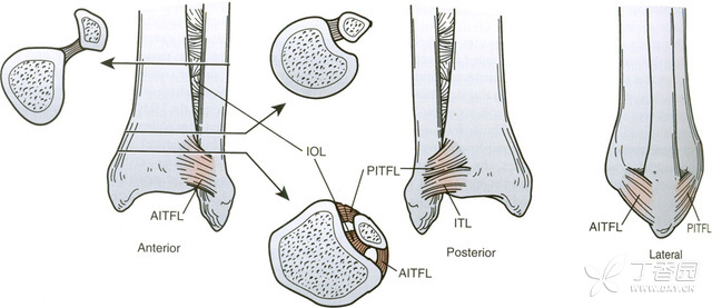 jbjs概念回顾:踝关节下胫腓联合韧带损伤