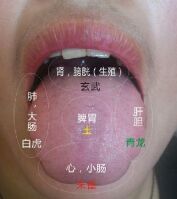 首先要看舌头形状:胖大舌头,有水,有瘀筋,有瘀脉,瘀血,脾肾阳虚.