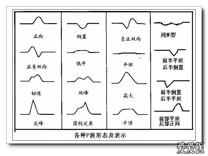 山羊老师课程常见心电图基础知识讲座第四讲p波方向来源分析