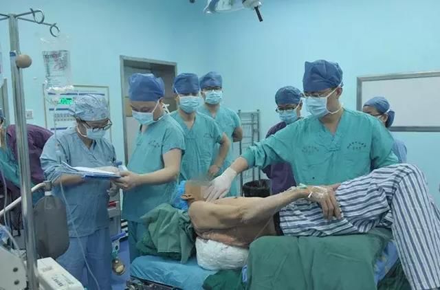 老人背部长出巨型肿瘤医生将其割下一脸盆装不下