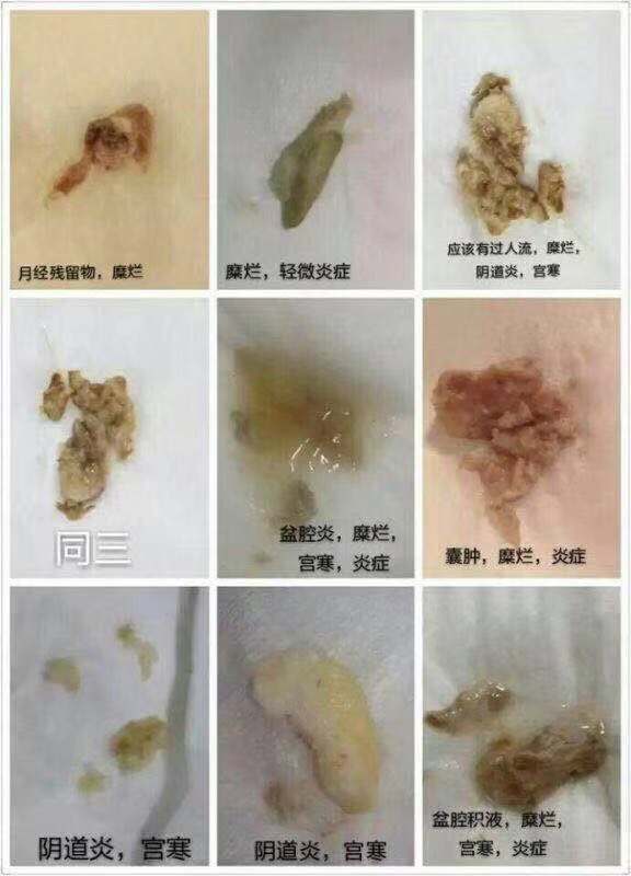 備孕可以使用麗爾維美草本抑菌凝膠嗎