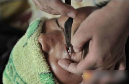 刀片兼具剃头,刮面和洗眼三种功能,铁制小圆棒则是每个人反复使用