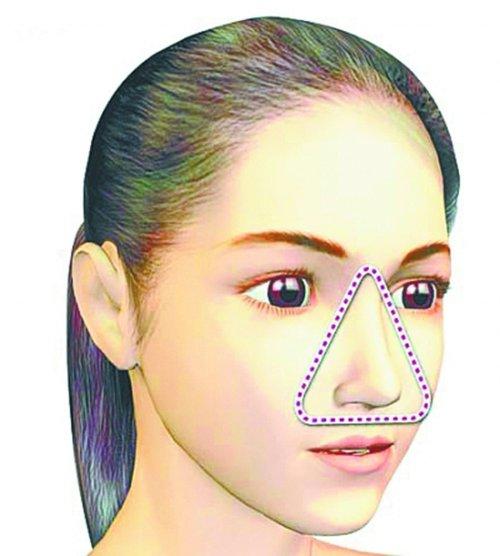 湖北11岁女孩挤青春痘引发重度骨髓炎危及生命