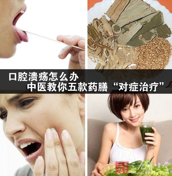 那麼得了口腔潰瘍怎麼辦呢?