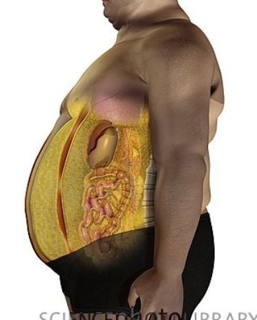 5张脂肪,肌肉.胖子,瘦子的科普图,看完你就明白了!