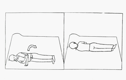 右侧外半规管耳石症手法复位示意图