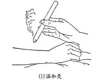 (3)回旋灸艾灸肚脐方法步骤1,温和灸:点燃艾条对准肚脐,距离皮肤约2-3