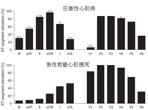 【心电学】赵运涛:应激性心肌病心电图的再认识