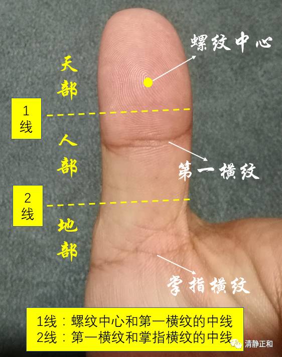 阴阳九针之针法个人经验