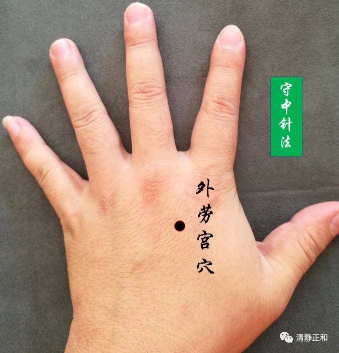 阴阳九针之针法个人经验