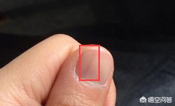 肝肾衰弱,体内有毒素中医上认为通常认为,如果手指甲上出现了黑色竖纹