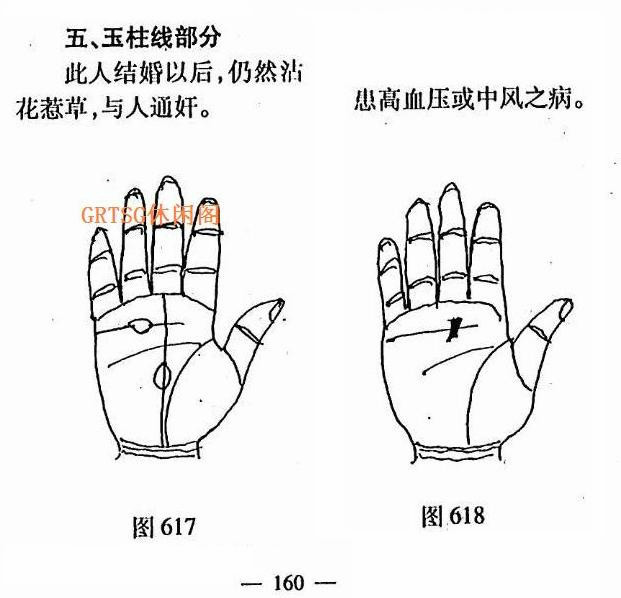 玉柱线分叉图解图片