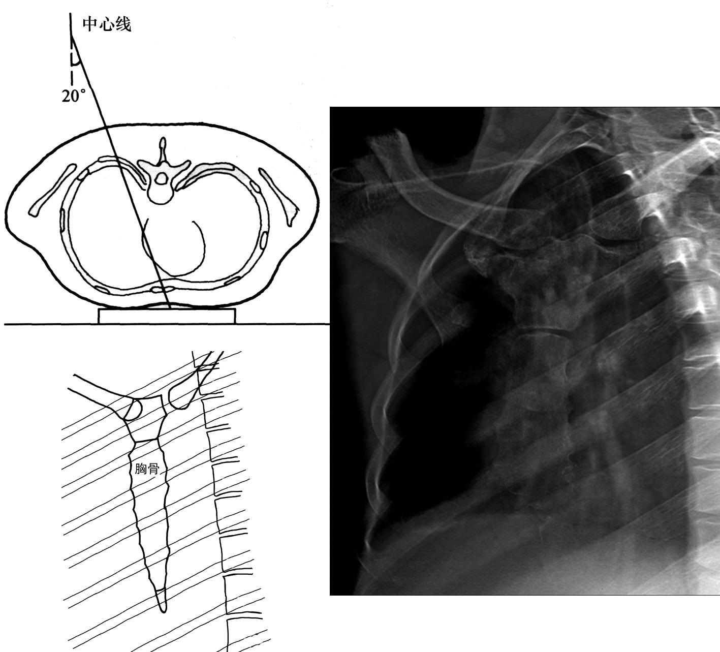 胸片侧位示意图图片