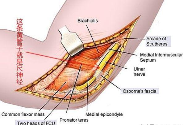无力,手部萎缩,手指夹拢张开无力则可能是肘部尺神经压迫的肘管综合征