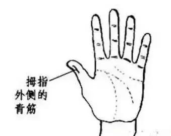 如果红得像朱砂掌,那就更加严重,但是你一定要问问这是不是偶尔发红