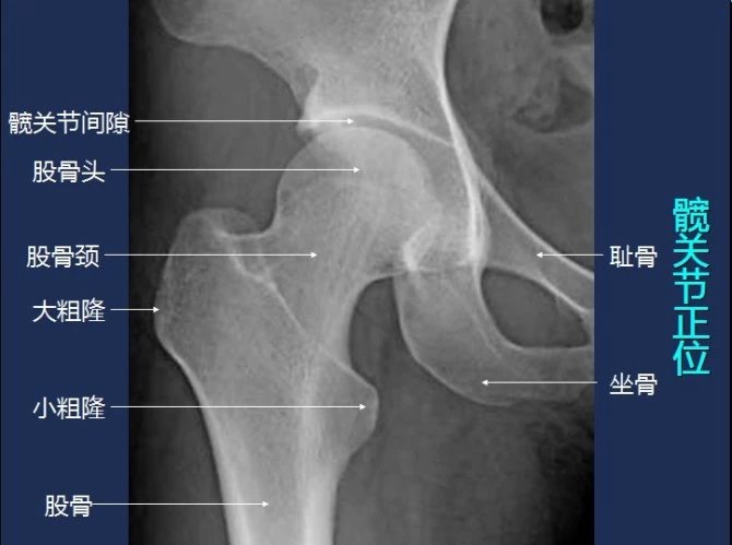 常规x线影像解剖大全