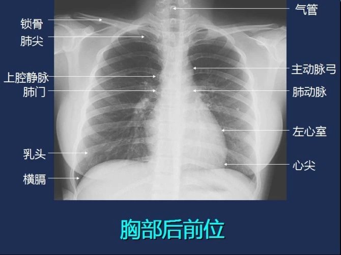 常规x线影像解剖大全